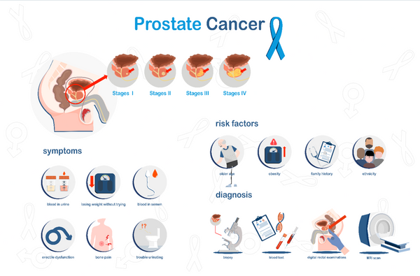 What Prostate Cancer Teaches Us About Listening to the Body