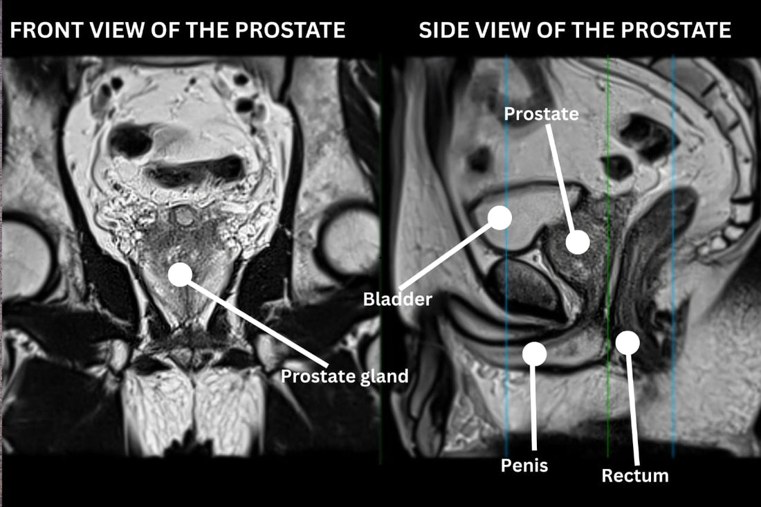 6 Tips to Improve Gut Health for a Healthy Heart