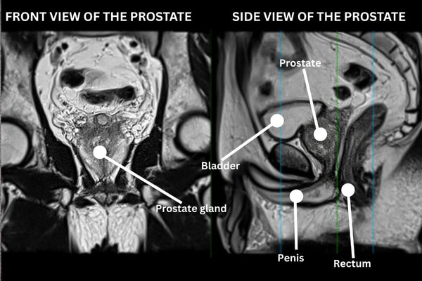 6 Tips to Improve Gut Health for a Healthy Heart